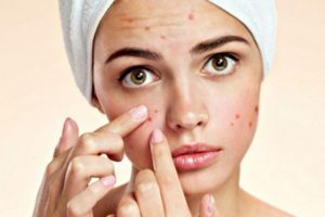 برداشتن خال