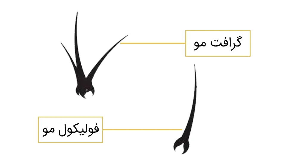 تفاوت فولیکول و گرافت