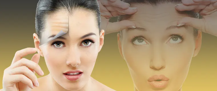 تزریق بوتاکس به پیشانی
