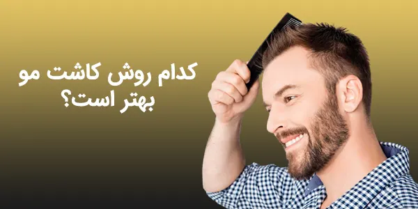 روش کاشت مو