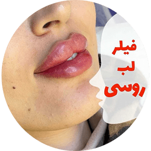 ژل لب روسی 11